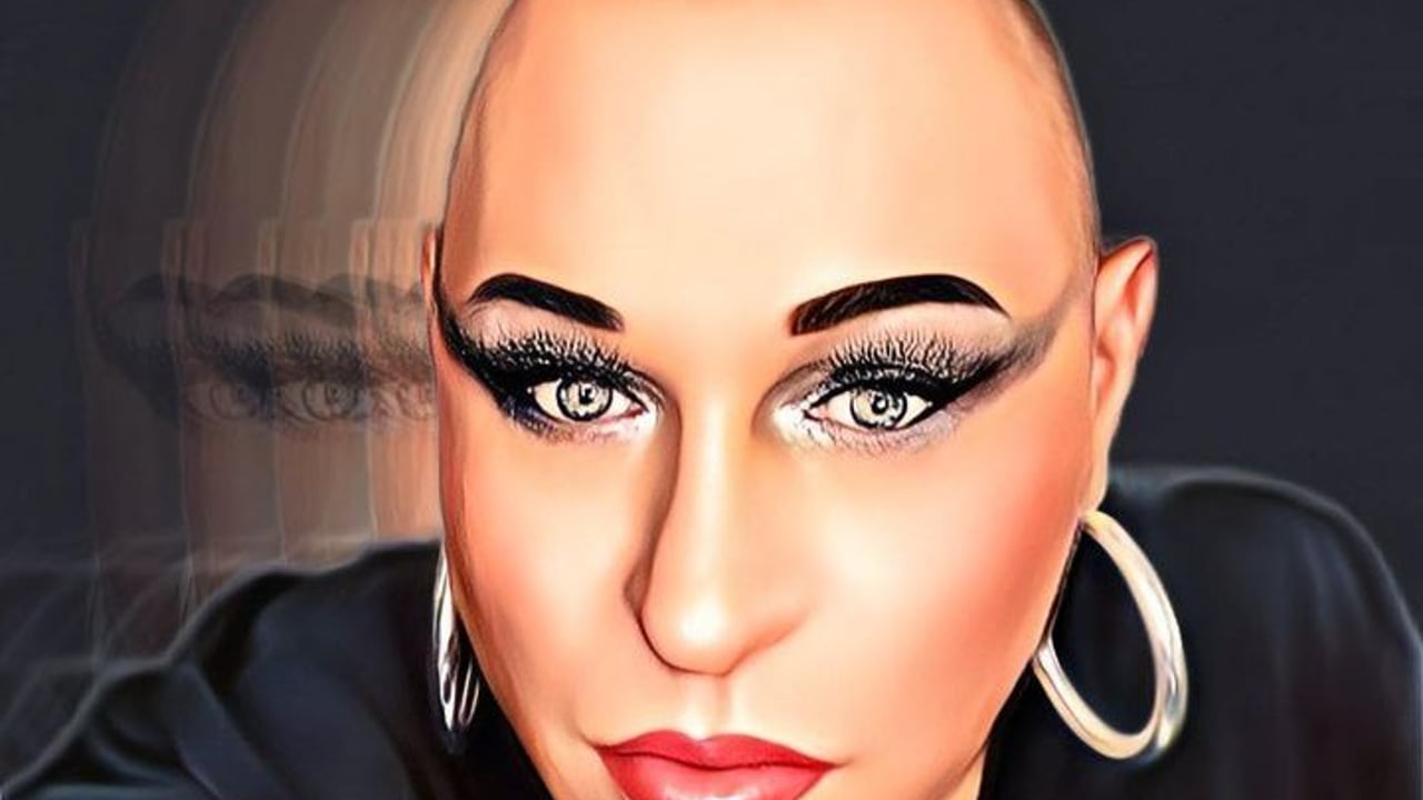 DJ Alexx Botox