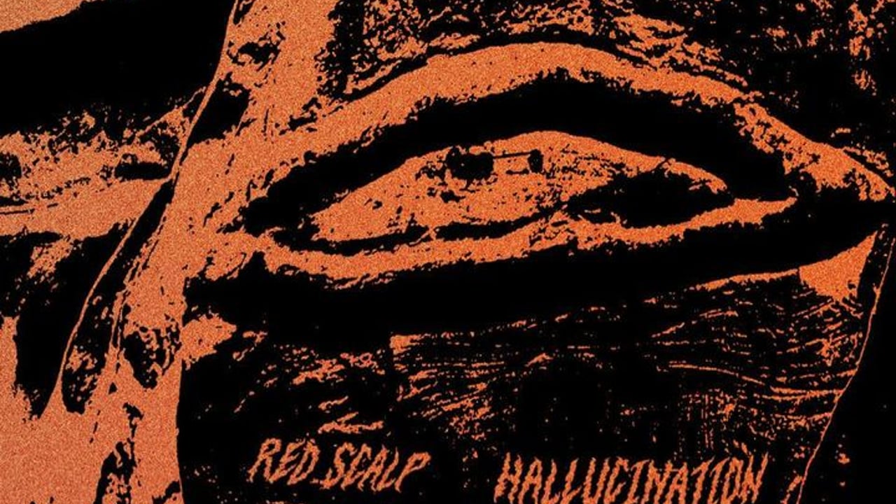 Red Scalp