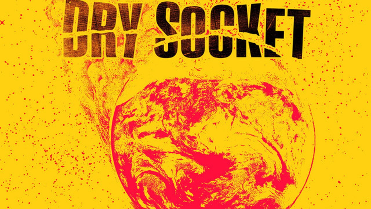 Dry Socket