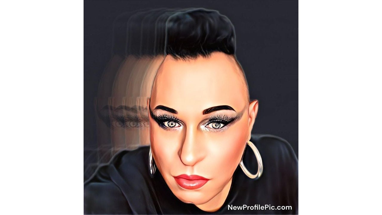 DJ Alexx Botox